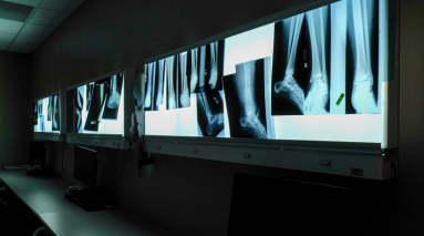 Image of xrays on wall
